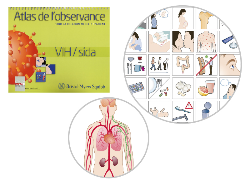 illustration scientifique atlas VIH/Sida