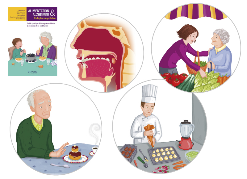 illustration scientifique alzheimer